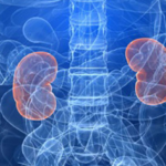 Kidney Disease: What You Should Know | UCLAMDCHAT Webinars (video)